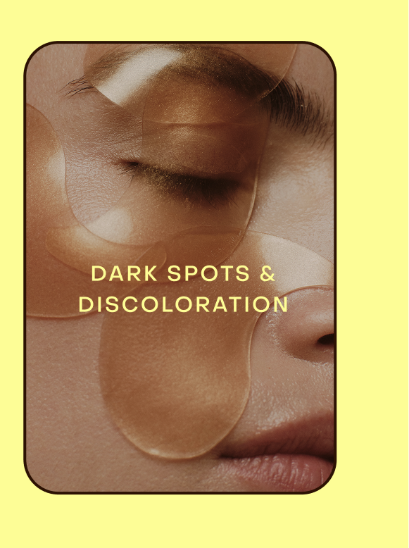 dark spots & discoloration