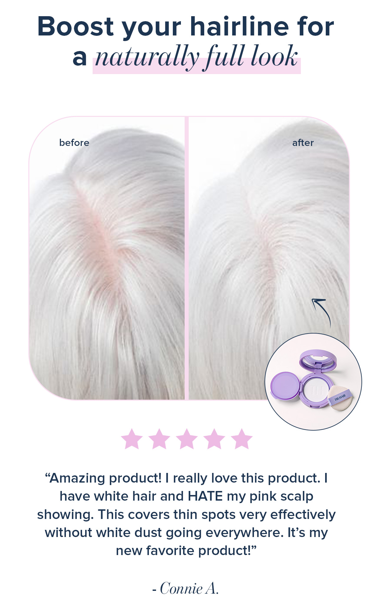 Before and After