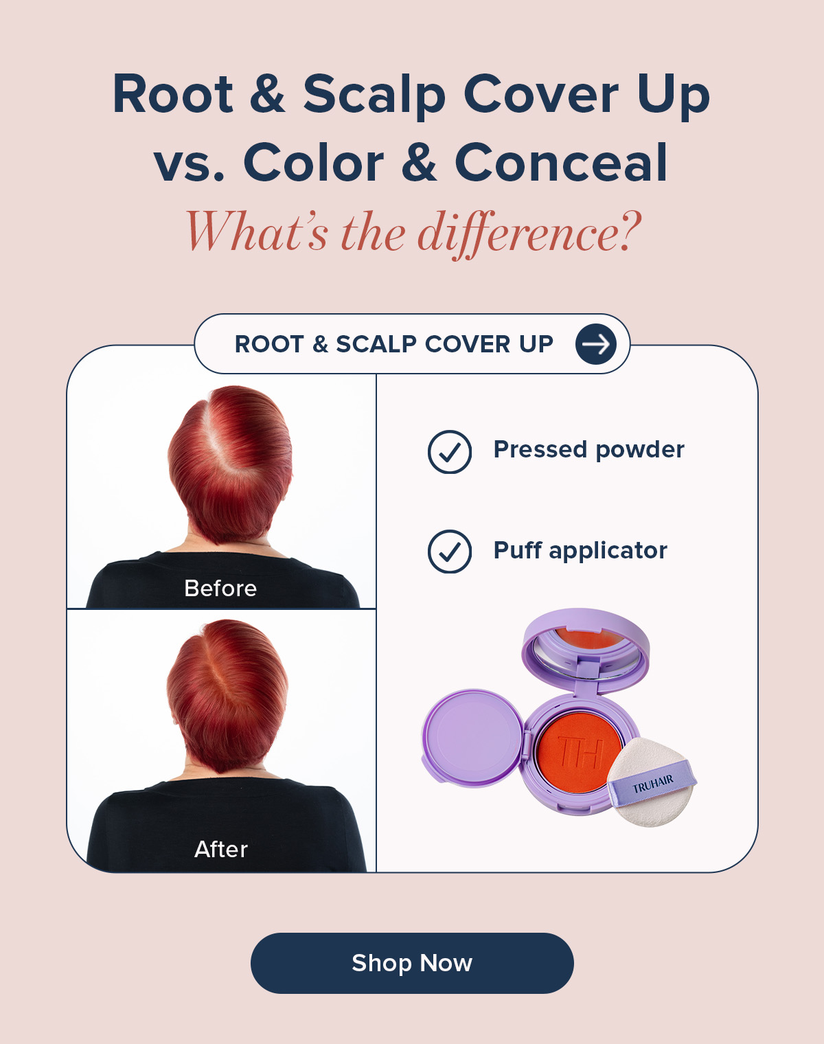 Root & Scalp Cover Up Vs Color and Conceal before and after