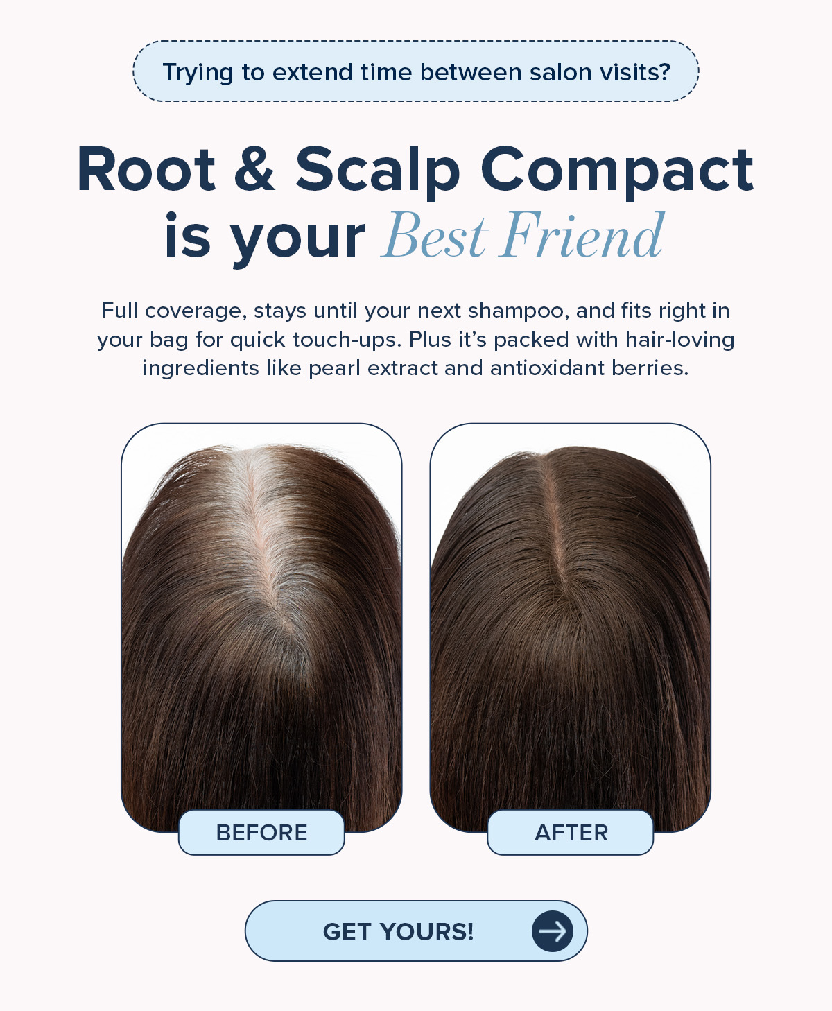 Root & Scalp Compact is your Best Friend