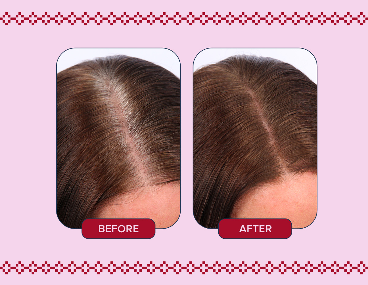 Before and After