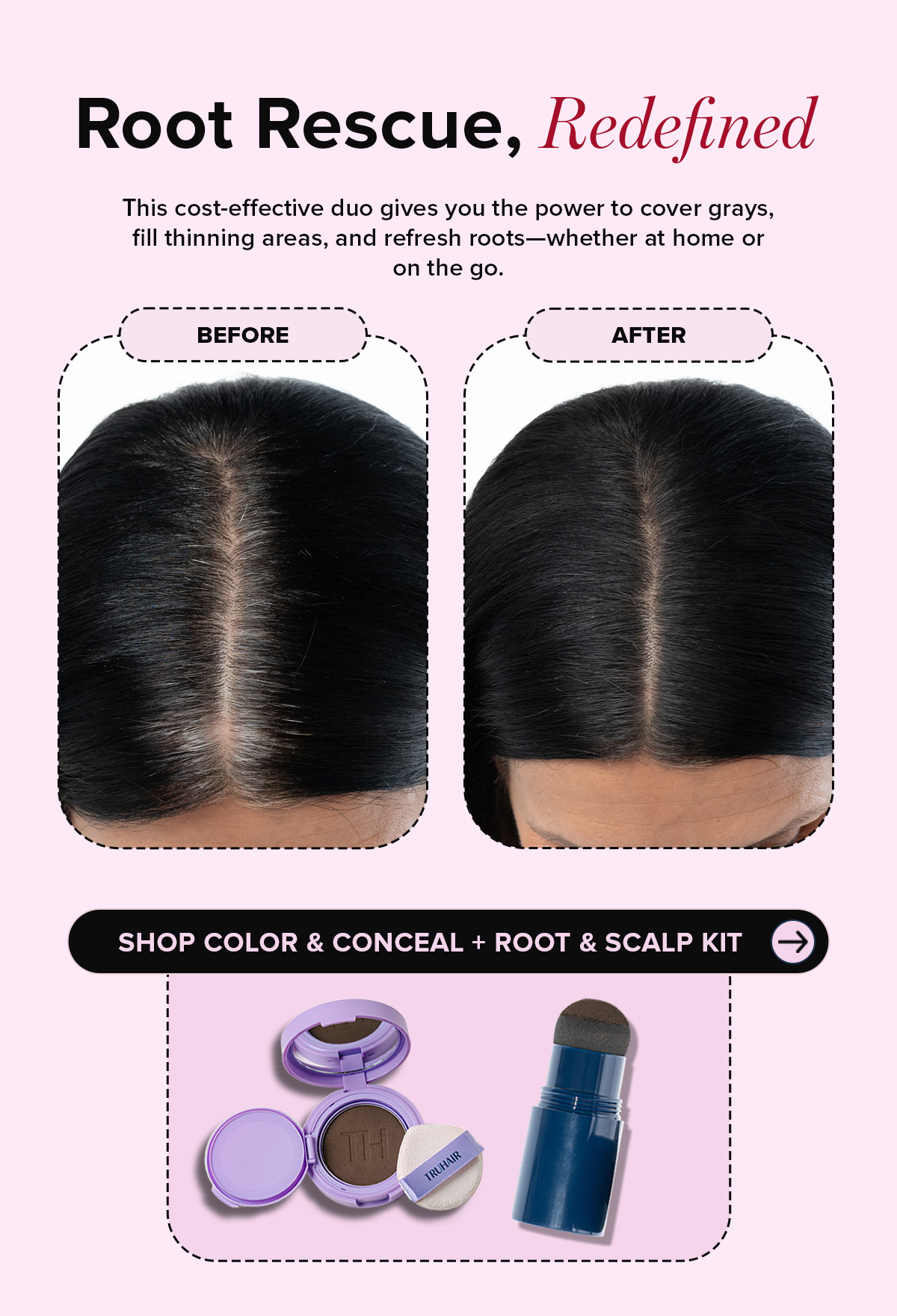 Shop Color & Conceal + Root & Scalp Kit