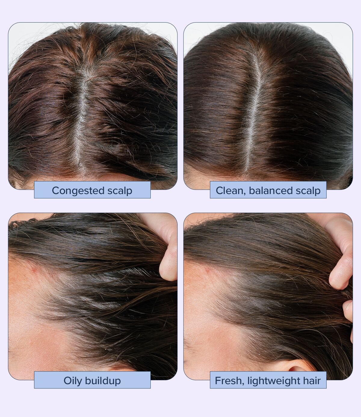 Before and after of using ampoule