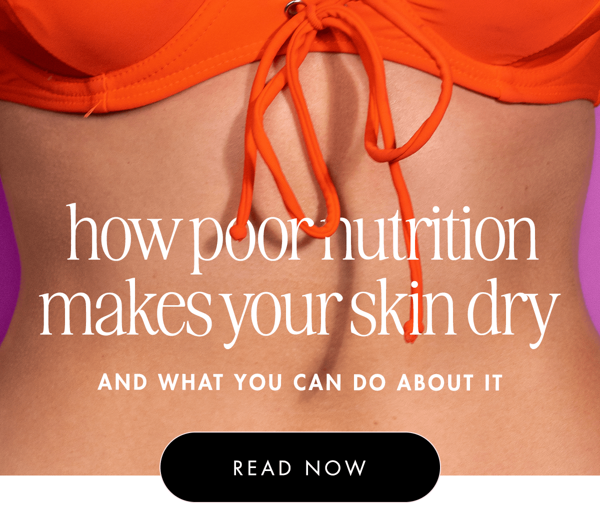 How Poor Nutrition Makes Your Skin Dry  And What You Can Do About It 
