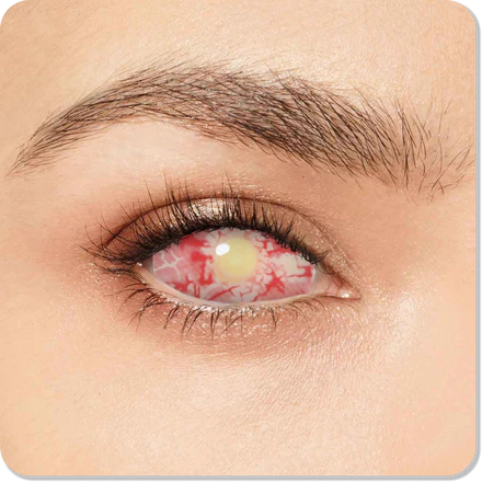 Patient Zero Sclera Eyes