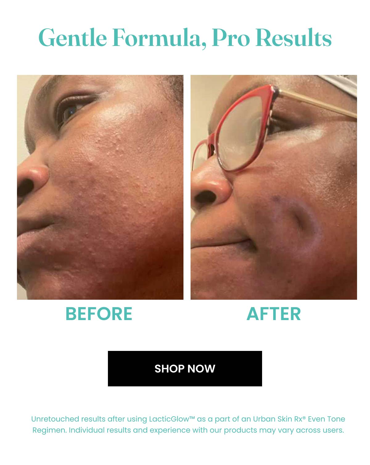 Gentle Formula, Pro Results