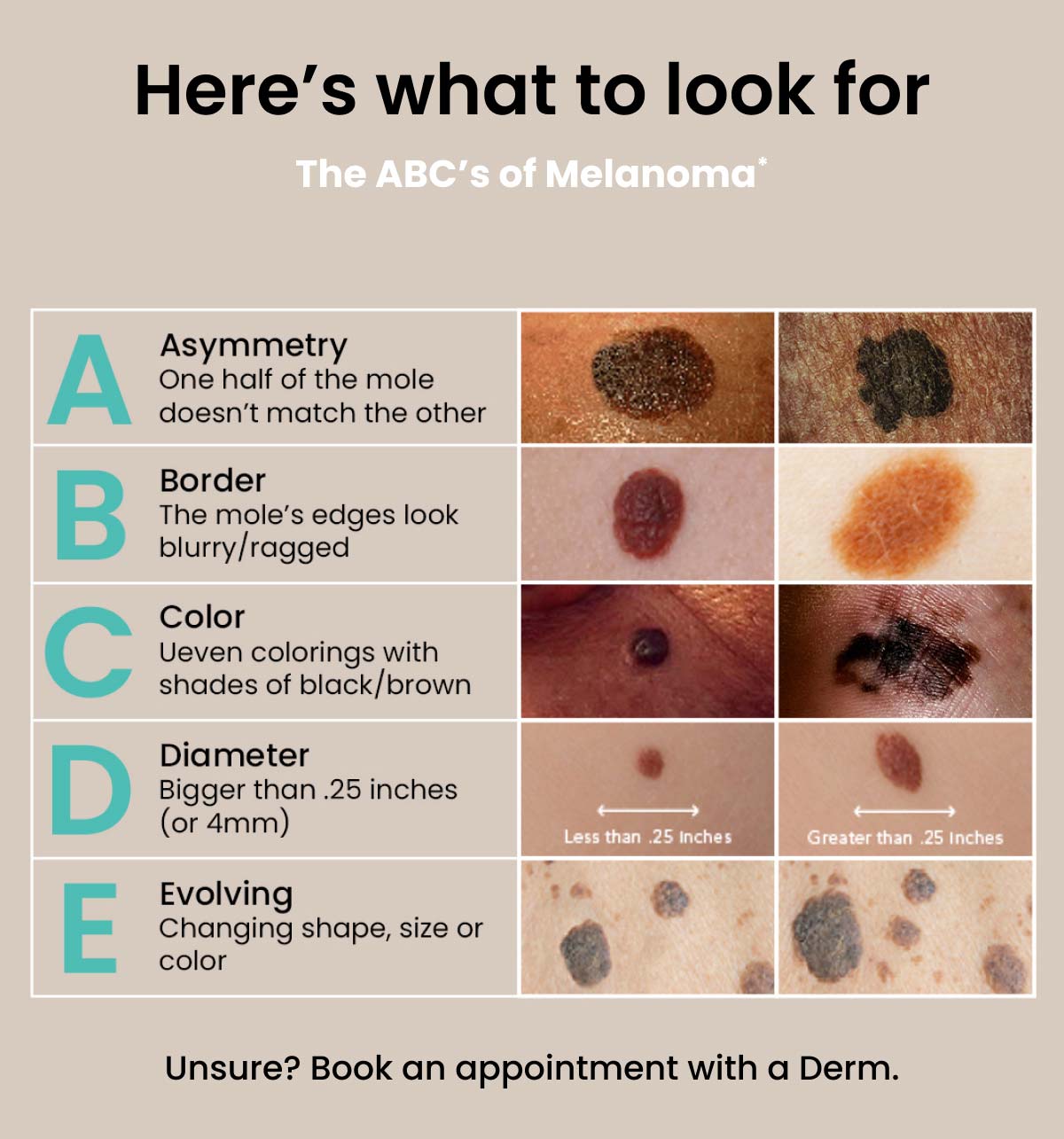 The ABCs of Melanoma