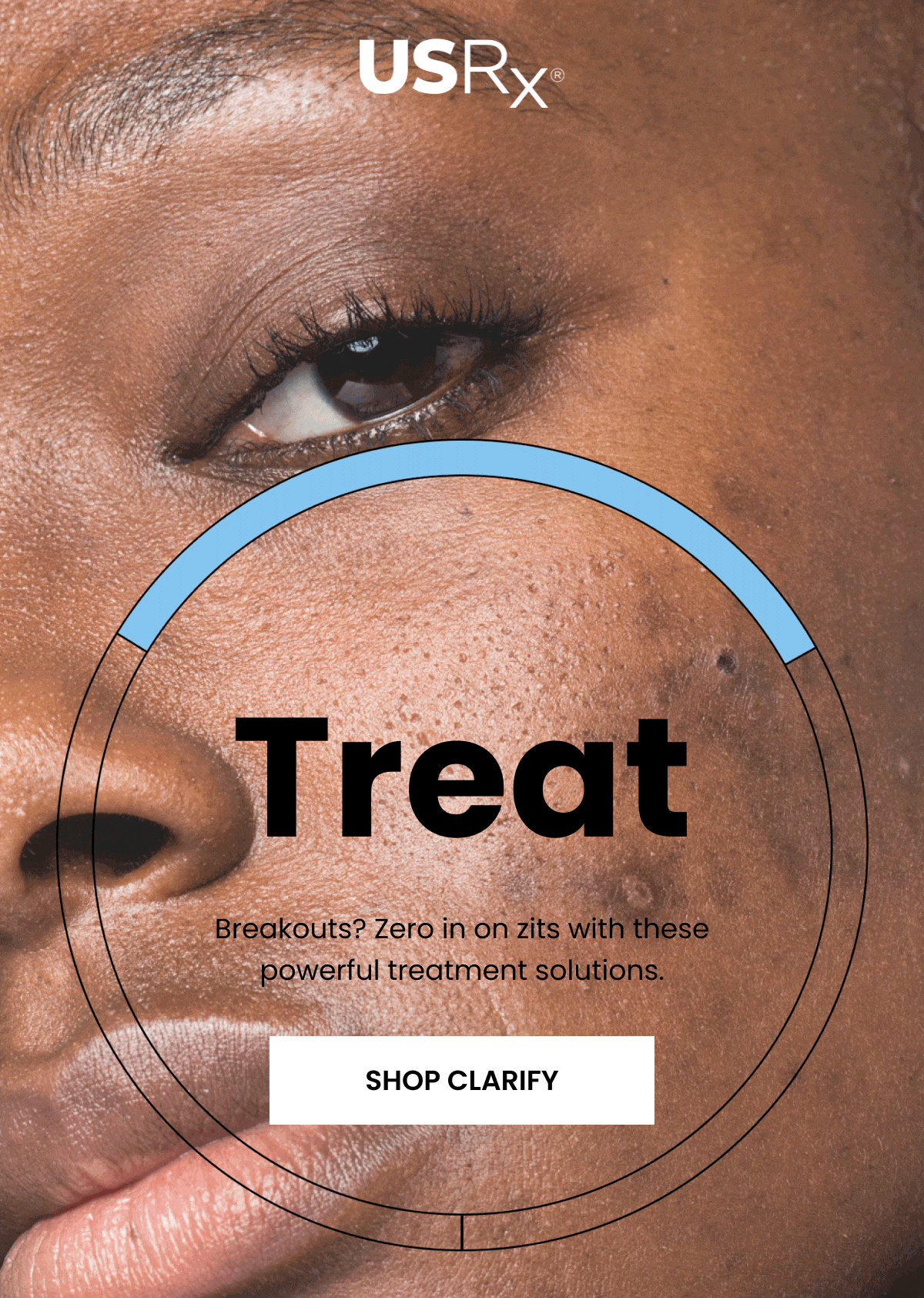  "Treat