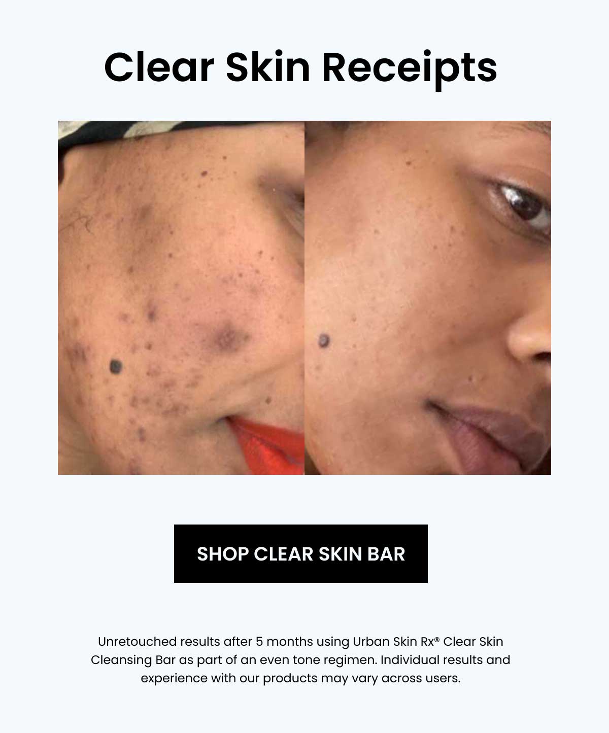 Clear Skin Receipts