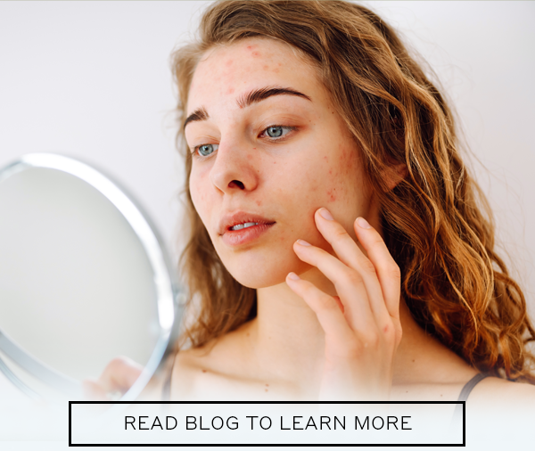 Read blog to learn more.