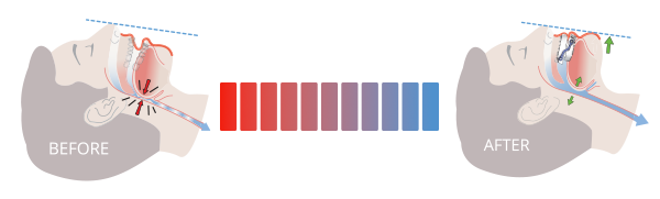 Silence Meter