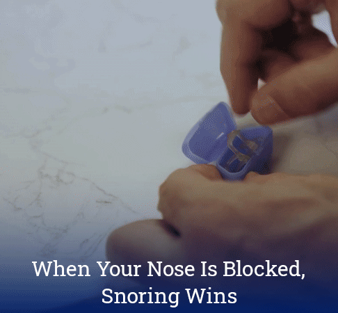 When Your Nose Is Blocked, Snoring Wins
