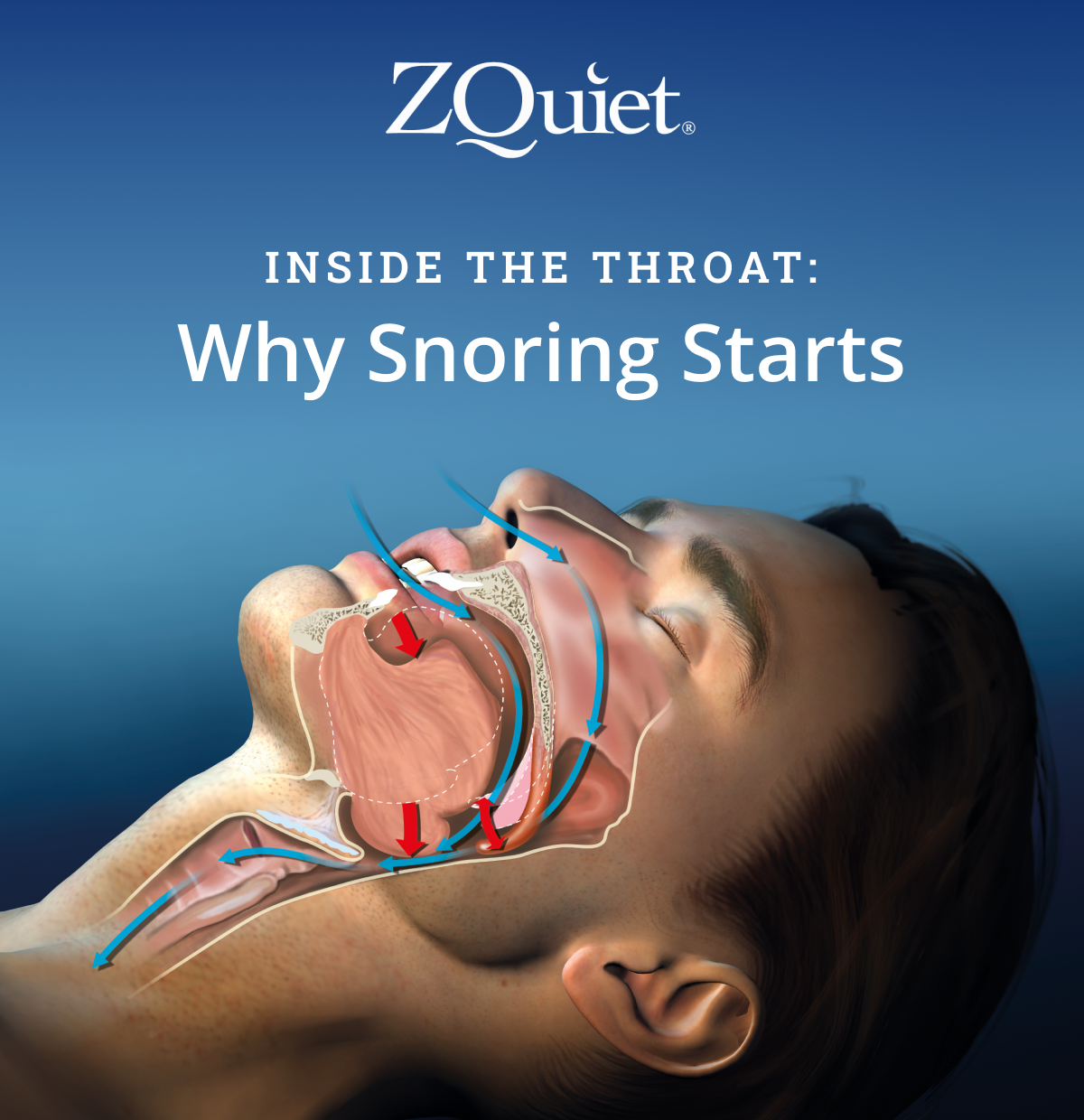 Inside the Throat: Why Snoring Starts
